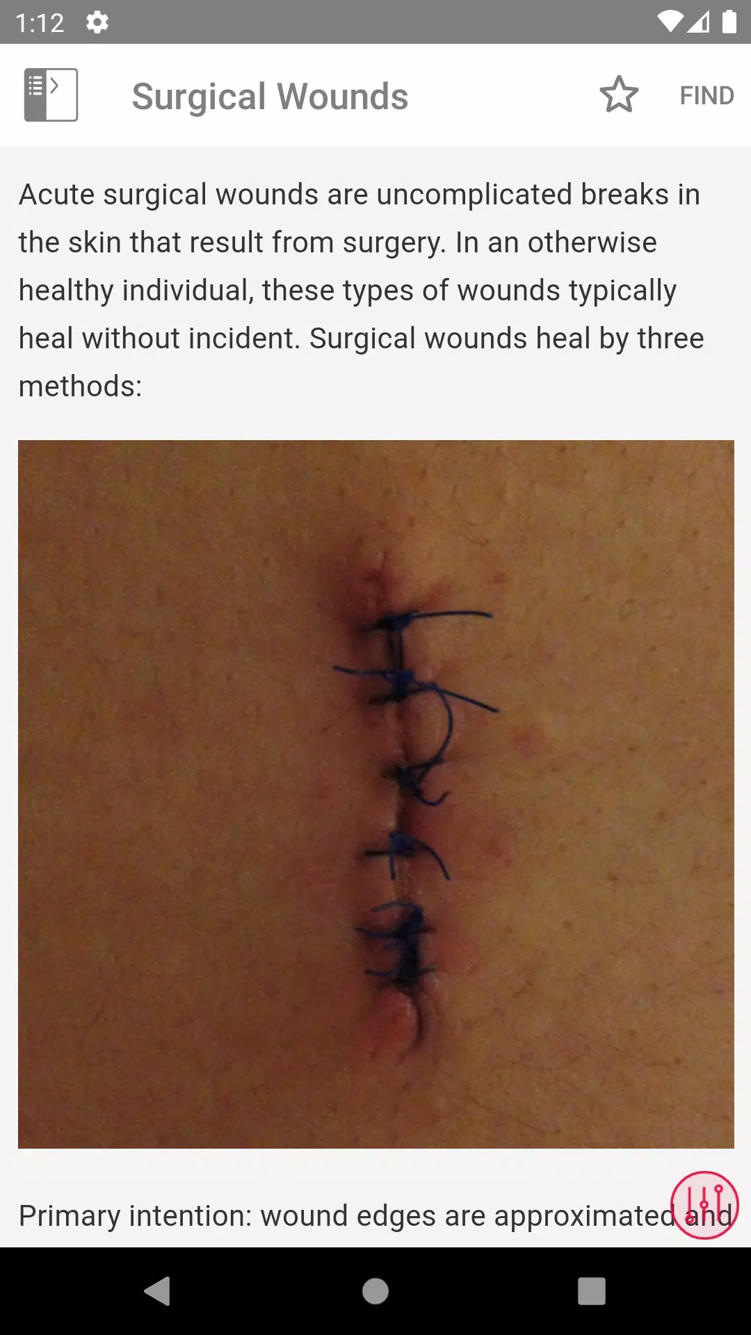 Wound Care MI Visual Zrzut ekranu 3