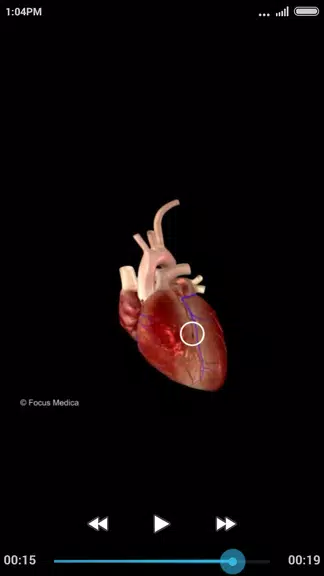 Cardiology-Animated Dictionary Capture d'écran 2